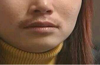 微量元素检测仪女神节福利女性长胡子内分泌紊乱 微量元素检测仪女神节福利女性长胡子内分泌紊乱