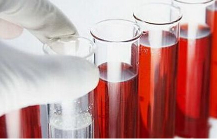 血液微量元素分析仪阐述微量元素与健康 血液微量元素分析仪阐述微量元素与健康