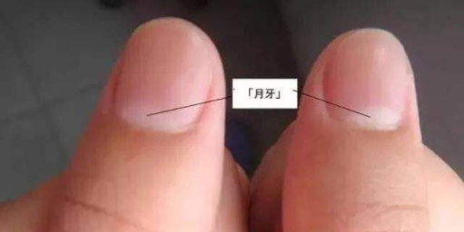 手指上没有月牙是缺少微量元素导致,月牙的多少就是健康的标准 手指上没有月牙是缺少微量元素导致,月牙的多少就是健康的标准