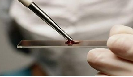 全自动微量元素分析仪检测的全血微量元素参考范围多少正常检测方法