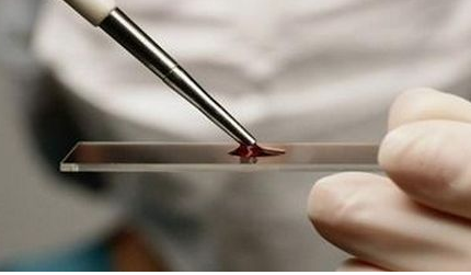 全自动微量元素分析仪检测的全血微量元素参考范围多少正常检测方法 全自动微量元素分析仪检测的全血微量元素参考范围多少正常检测方法