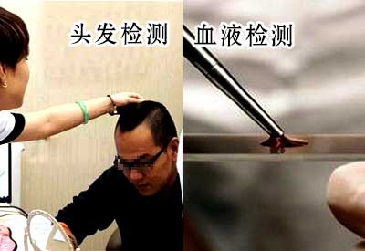 微量元素检测仪介绍做身体微量元素检查用头发还是血液哪个更靠谱