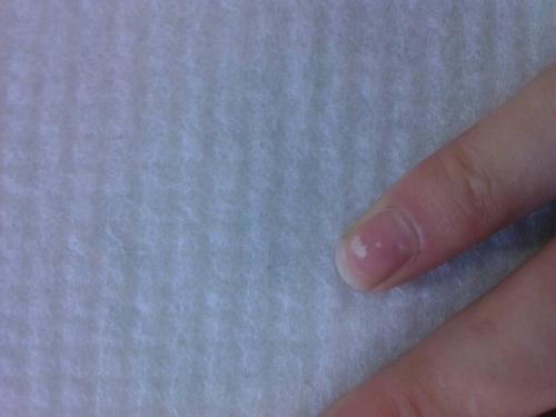 儿童医用钙铁锌硒检测仪指甲上的白点是什么呢?缺少微量元素怎么补?
