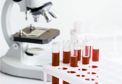 显微镜看血液骗局-显微镜下能看到血液里的垃圾么?
