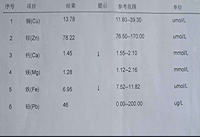 微量元素检测仪价格多少我要去医院做一次微量元素检查多少钱? 微量元素检测仪价格多少我要去医院做一次微量元素检查多少钱?